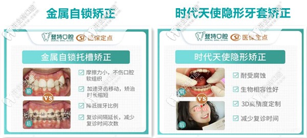 登特口腔：复杂牙齿矫正案例展示