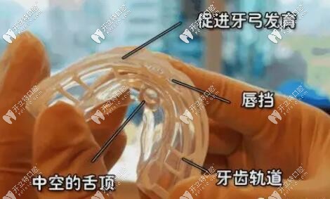 mrc矫治器的作用 mrc矫治器的作用