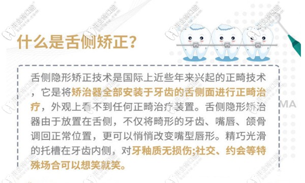 青岛马泷齿科的正畸价目表 青岛马泷齿科的正畸价目表