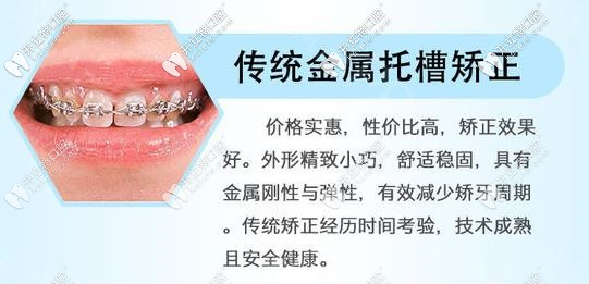 20210225966859.jpg 091-金属矫正优势_副本.jpg