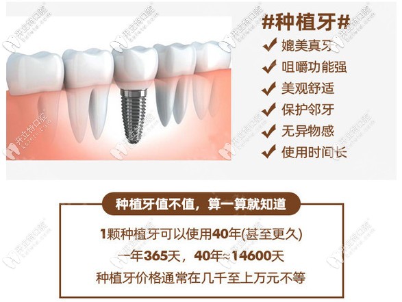 襄阳时代口腔：种植牙的优势及使用寿命