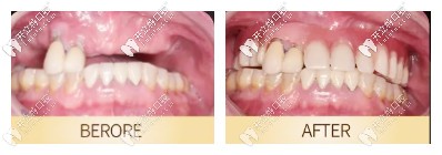 昆明柏德口腔案例 昆明柏德口腔案例