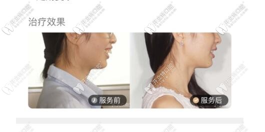 牙齿矫正<span style=