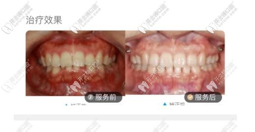 QQ截图20210301131923.jpg