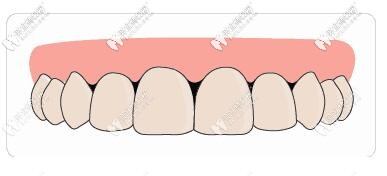 牙齿变长牙缝变宽...注意!你的牙龈正在萎缩!附赠拯救大法