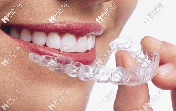 透明隐形牙套