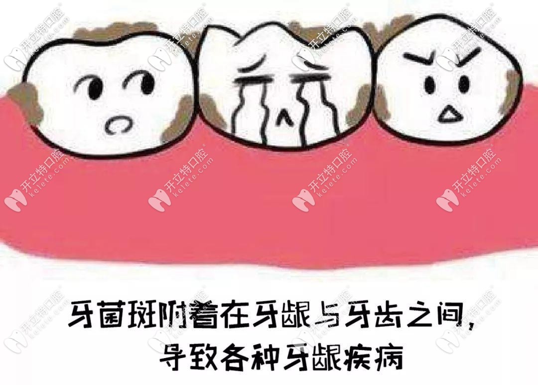 牙菌斑不清楚会出现各种牙齿疾病 牙菌斑不清楚会出现各种牙齿疾病