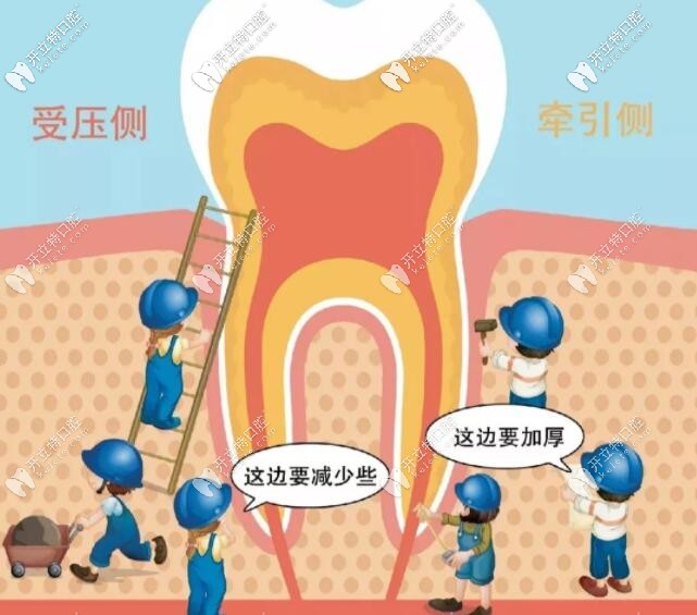 牙槽骨稳固