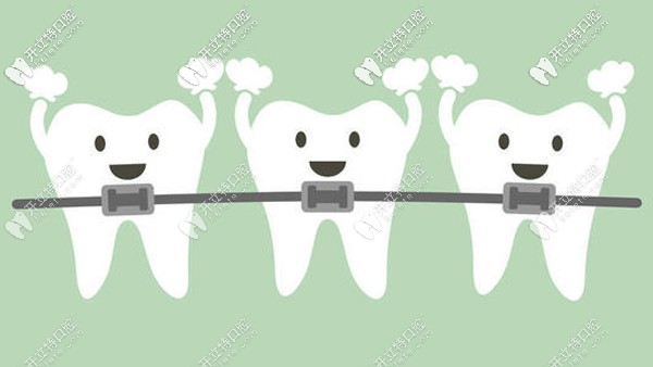 常见的牙齿矫正的类型有哪些