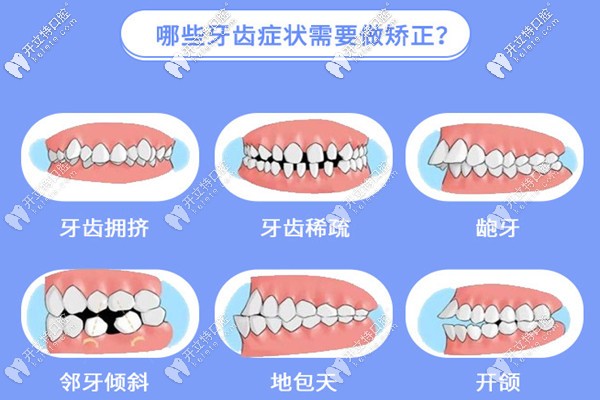 宝山区罗缘口腔正畸技术怎么样