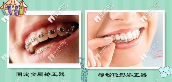 西宁时光口腔医院：金属牙套和隐形牙套