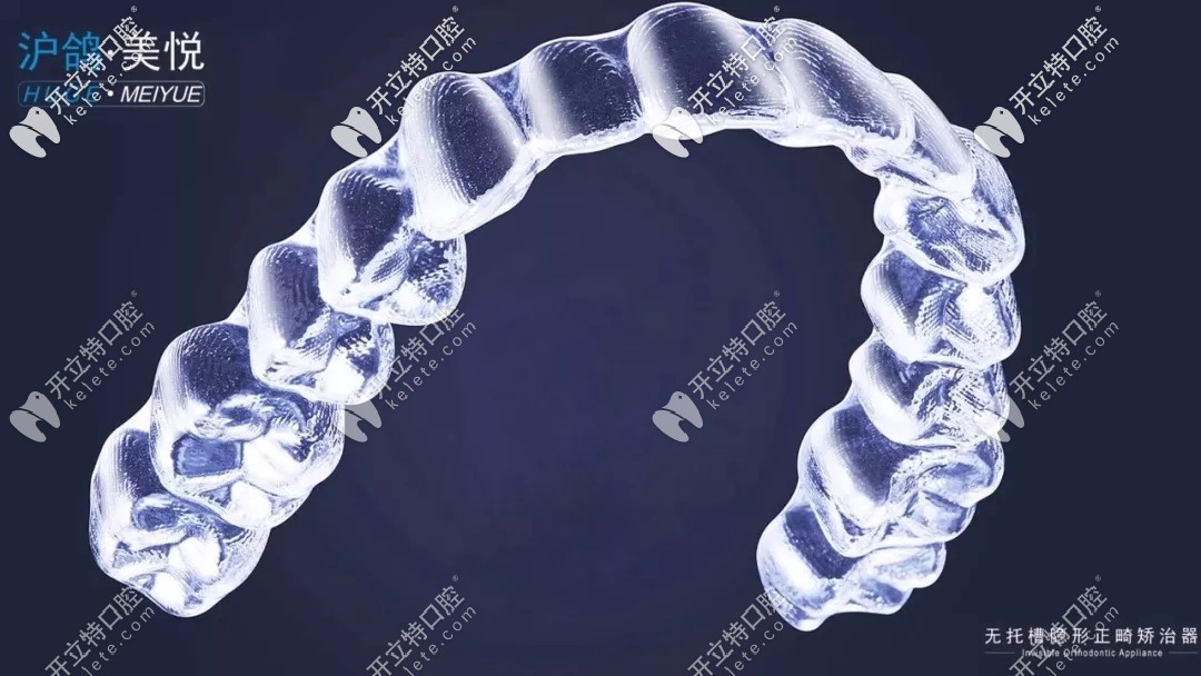 沪鸽美悦矫正器咋样?关于沪鸽隐形牙套的价格及病例这都有