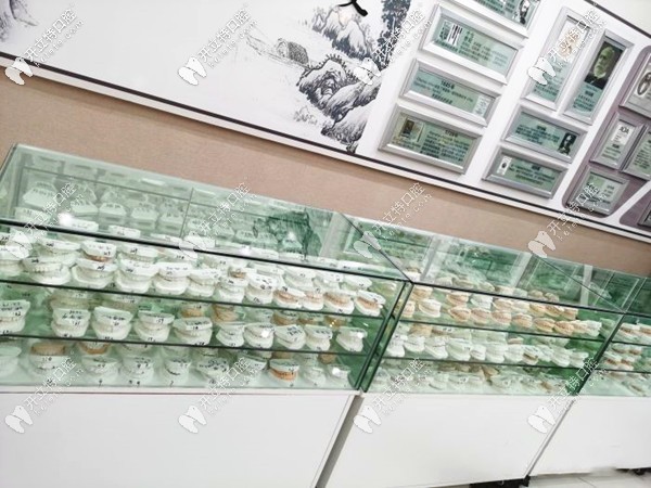 重庆齐美口腔牙套模型 重庆齐美口腔牙套模型