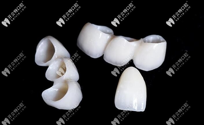 瑞典procera全瓷牙价格辣么贵,算是比较好的进口全瓷牙冠品牌吗