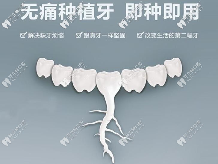 诚适口腔牙齿种植技术