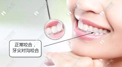 正常的牙齿咬合示意图