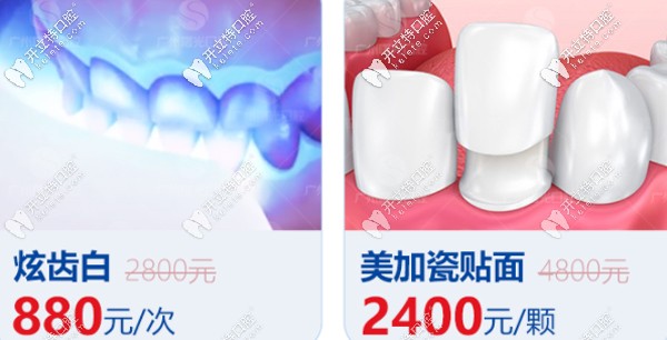 曙光牙科牙齿美白优惠详情 曙光牙科牙齿美白优惠详情