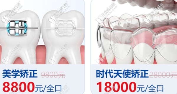 曙光牙科正畸优惠活动 曙光牙科正畸优惠活动