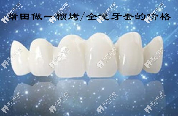 莆田做一颗烤/全瓷牙套的价格