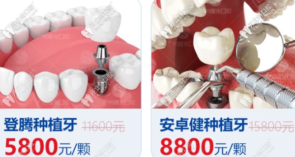 广州曙光口腔种植牙优惠 广州曙光口腔种植牙优惠