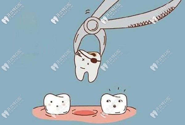 拔牙多久种植牙最好，拔牙后延期种牙最佳时期为3-6个月