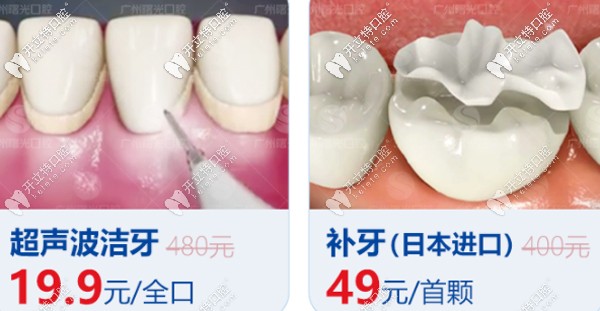 曙光口腔洗牙、补牙优惠看这 曙光口腔洗牙、补牙优惠看这