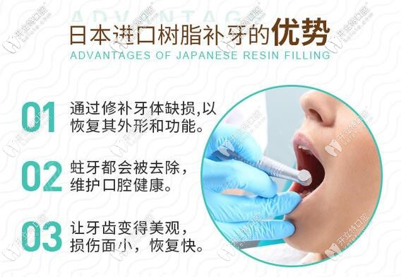 日本进口树脂补牙材料的优点所在