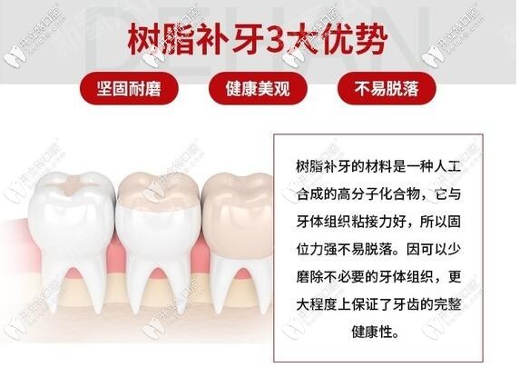 十大树脂补牙材料品牌排行榜，看清价格贵的和便宜的区别