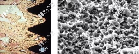 种植体slactive什么意思知道吗?除了iti亲水种植体品牌了解下