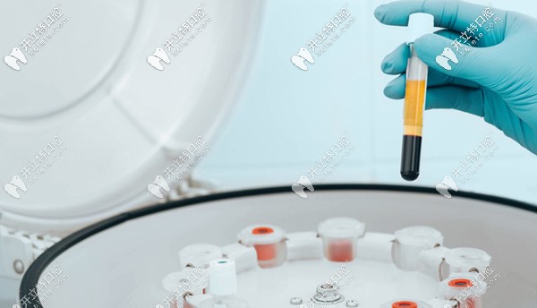 什么是生长因子种植牙技术