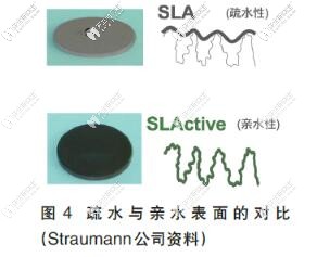 亲水种植体与非亲水种植体表面区别 亲水种植体与非亲水种植体表面区别