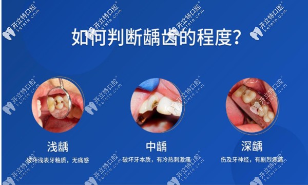 如何判断邻面龋的程度 如何判断邻面龋的程度