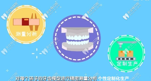 eta牙套进行个性定制化生产 eta牙套进行个性定制化生产