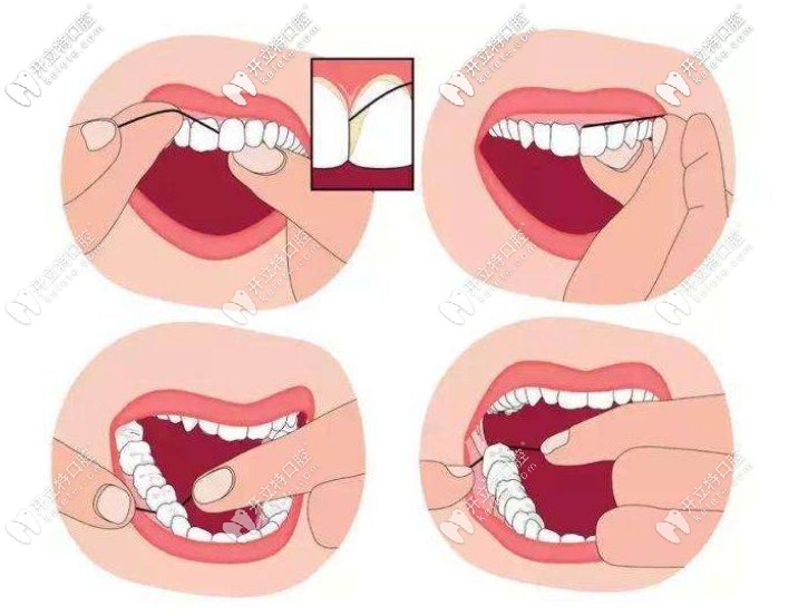 正确使用牙线的方法