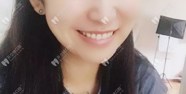 矫正后的效果 矫正后的效果