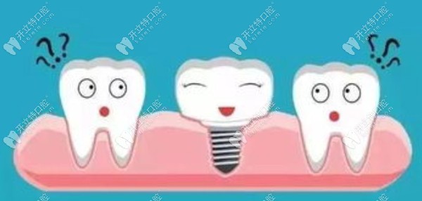 微创种植牙的利弊有哪些