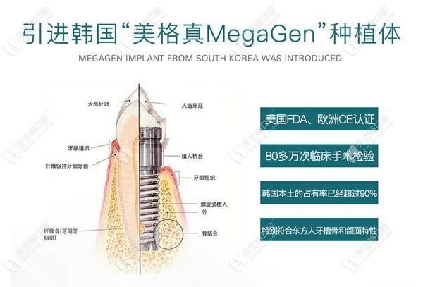 为啥都想看韩国美格真EZplus型号的介绍和种植流程图呢