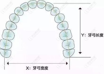 牙弓