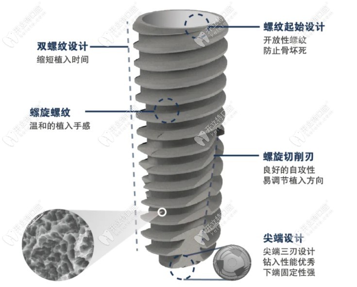 韩国奥齿泰ts3 SA植体怎么样呢?据说很适合即拔即种即刻负重