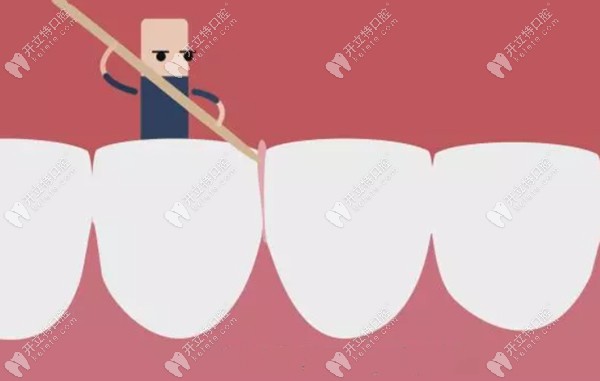 用牙签剔牙会导致牙缝变宽变大!正确的剔牙方法赶紧学起来