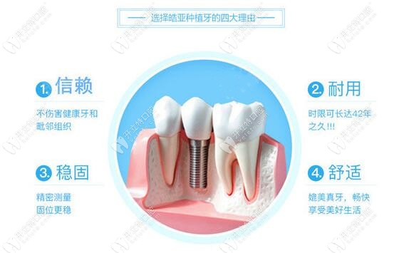 HIOSSEN皓圣种植系统的4大优势 HIOSSEN皓圣种植系统的4大优势