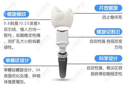 皓圣种植体的结构形成 皓圣种植体的结构形成