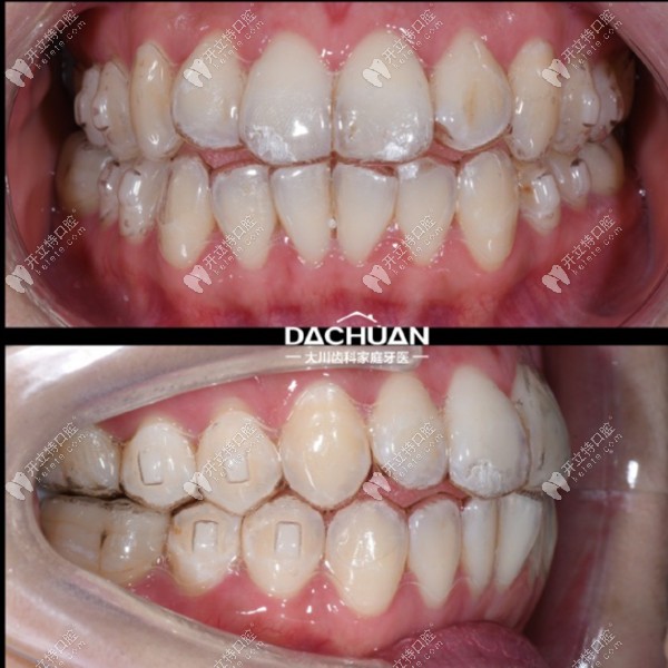 3723633699_33426181180_F8EA<span style=