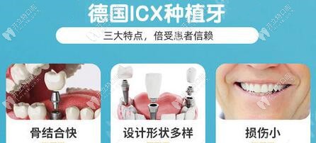 德系ICX种植体的三大特点 德系ICX种植体的三大特点