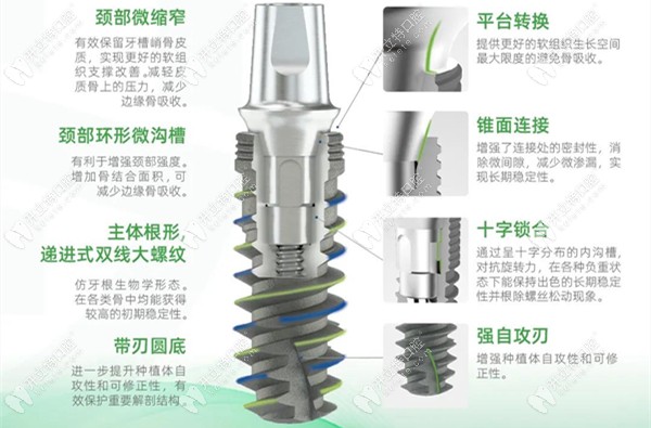 山东泰山种植体的内部结构介绍