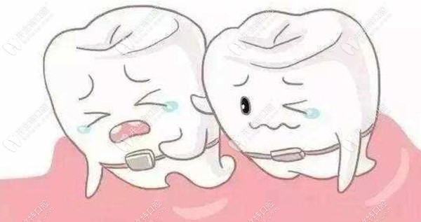 牙齿二次矫正有啥危害