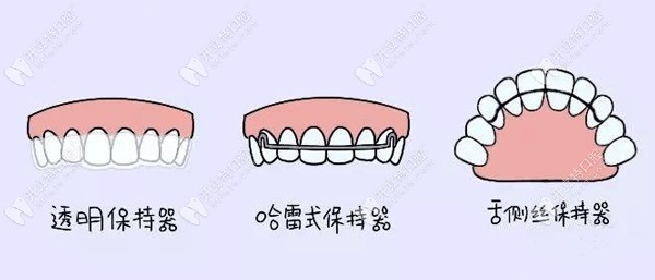 常见保持器类型