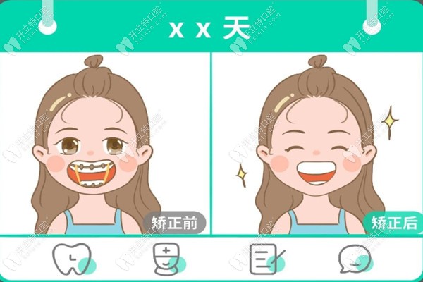 广州圣贝口腔矫正 广州圣贝口腔矫正