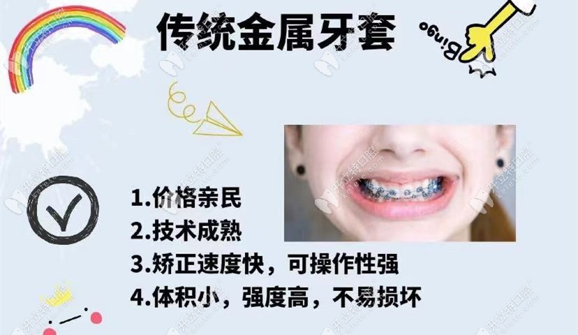 钢牙套优点