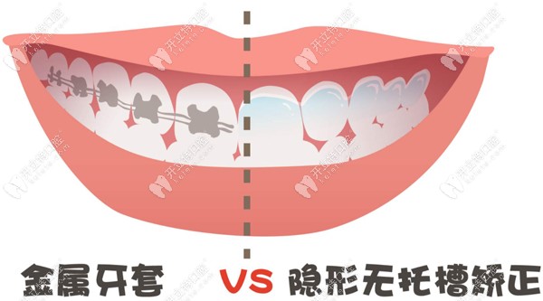 朔州市牙齿矫正参考价格 朔州市牙齿矫正参考价格